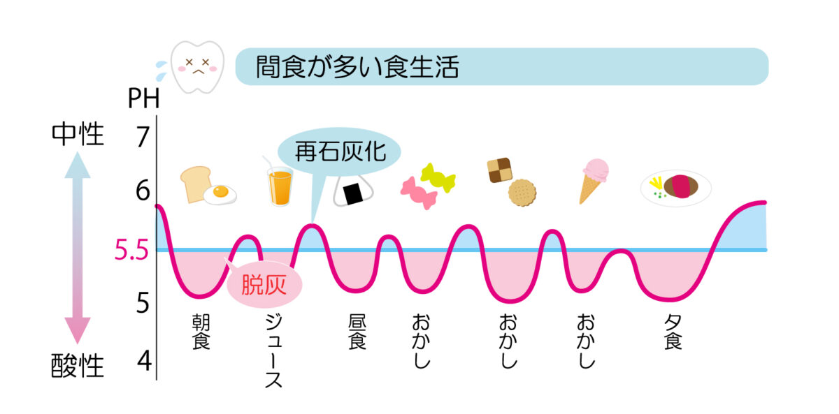 間食や甘い飲み物のたびにpHが下がり、回復前に再び低下する様子を示すステファンカーブ
