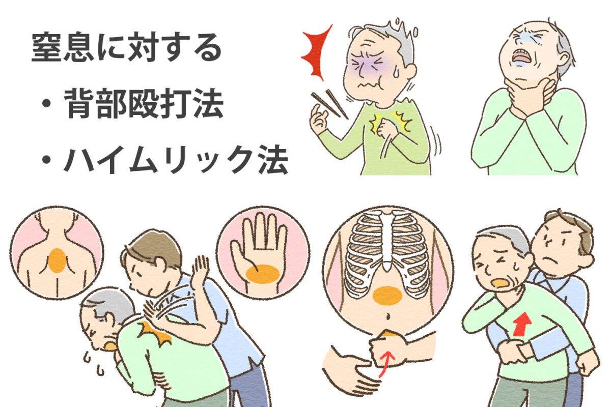 窒息のサインと背部叩打法、腹部突き上げ法を示す図
