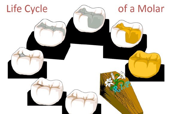 図5 英語の円環図「Life Cycle of a Molar」。ほぼ健全な大臼歯から、着色、小さな詰め物、大きな詰め物、金属の被せ物を経て、R.I.P.と書かれた棺に至る歯の絵を円に並べている