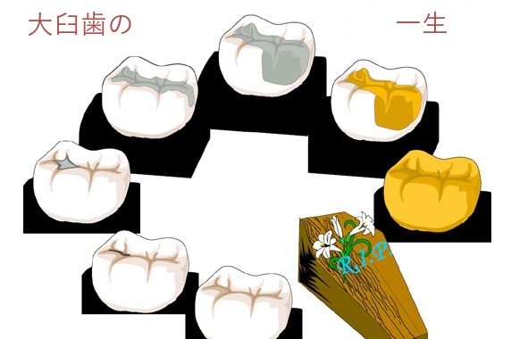 図5の和訳。題は「大臼歯の一生」。歯の絵が円に並び、棺で終わる