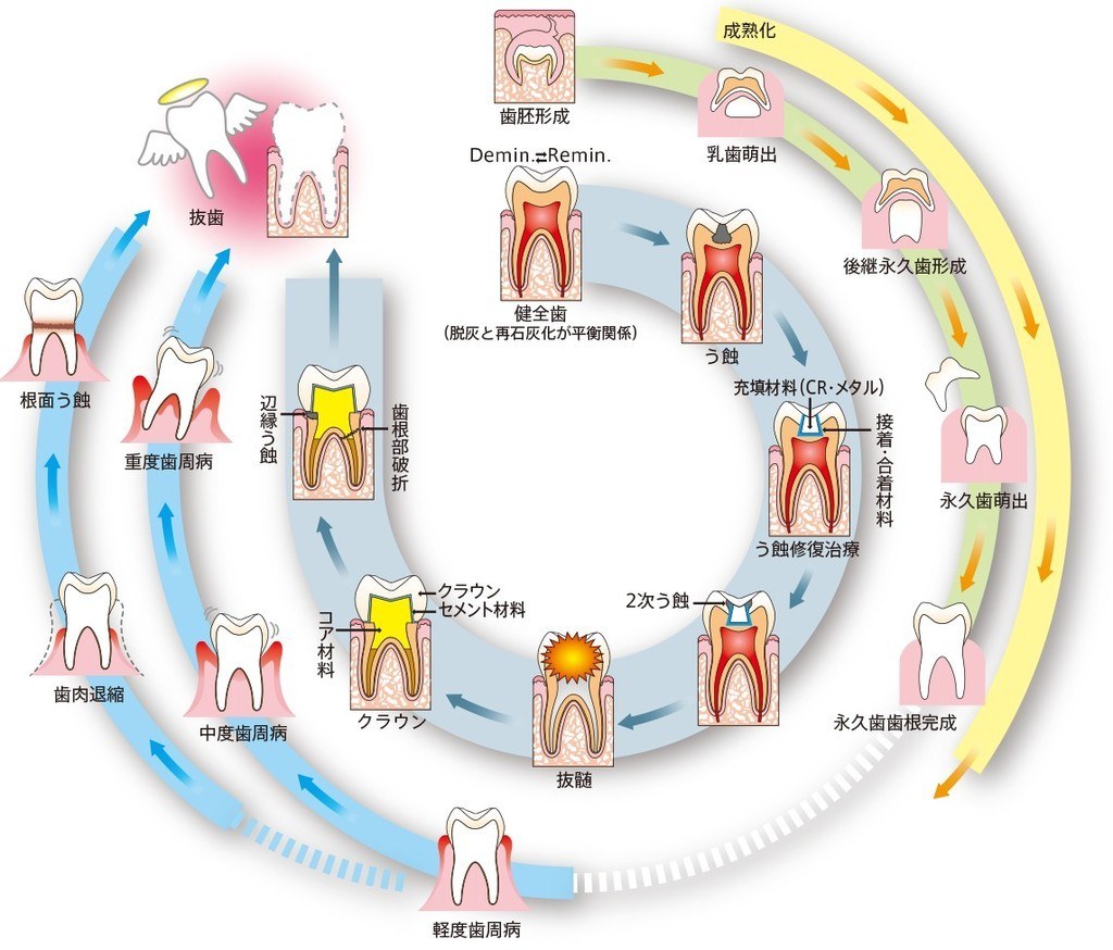 図6 松風の図「歯の発生・成熟と歯の喪失に向かった負のスパイラル」。中央の円環に図1と同じ構図の歯のイラストが並び、外側に歯の発生と萌出、歯周病の進行の流れが描かれている