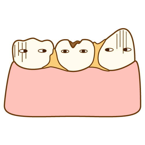 汚れや虫歯で困っている歯のキャラクター