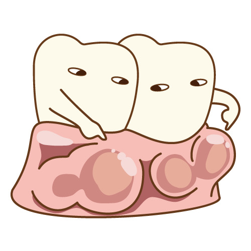 歯ぐきのふくらみを指す歯のキャラクター