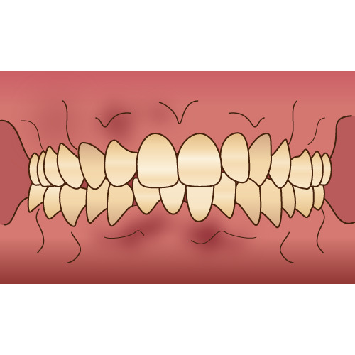 歯とピンク色の歯ぐきを示したイラスト