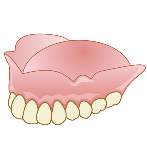 上あご用の総入れ歯のイラスト
